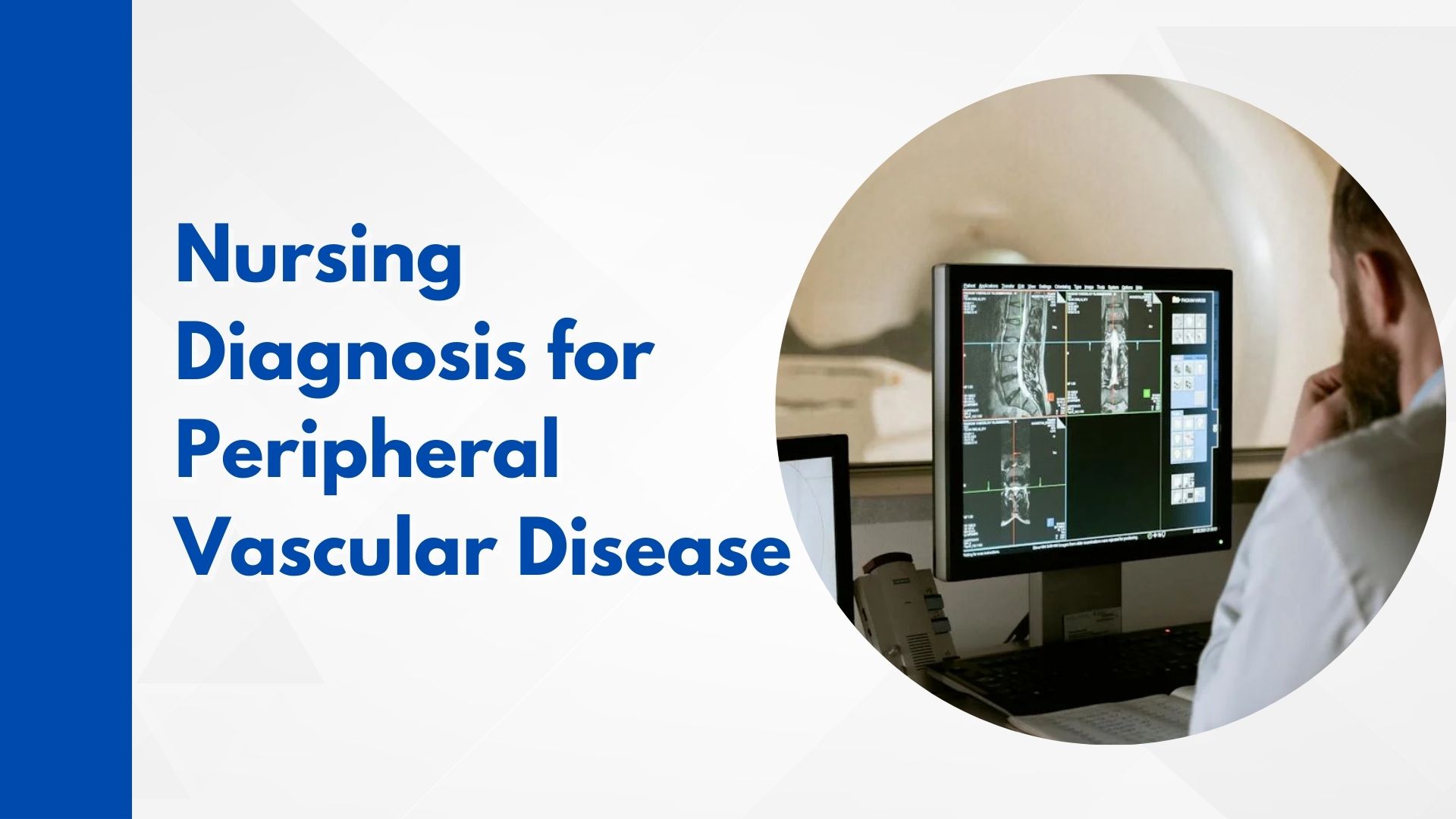 Nursing Diagnosis for Peripheral Vascular Disease: A Comprehensive Approach