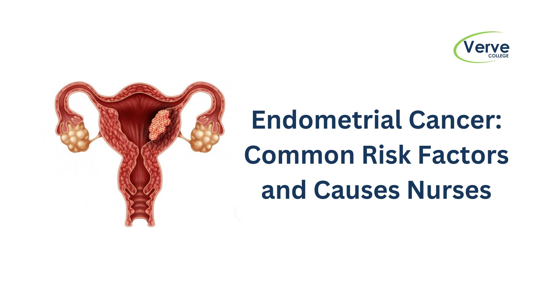 Endometrial Cancer: Common Risk Factors and Causes Nurses