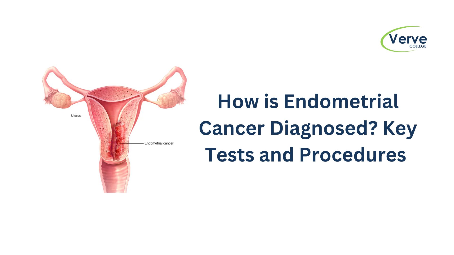 How is Endometrial Cancer Diagnosed? Key Tests and Procedures