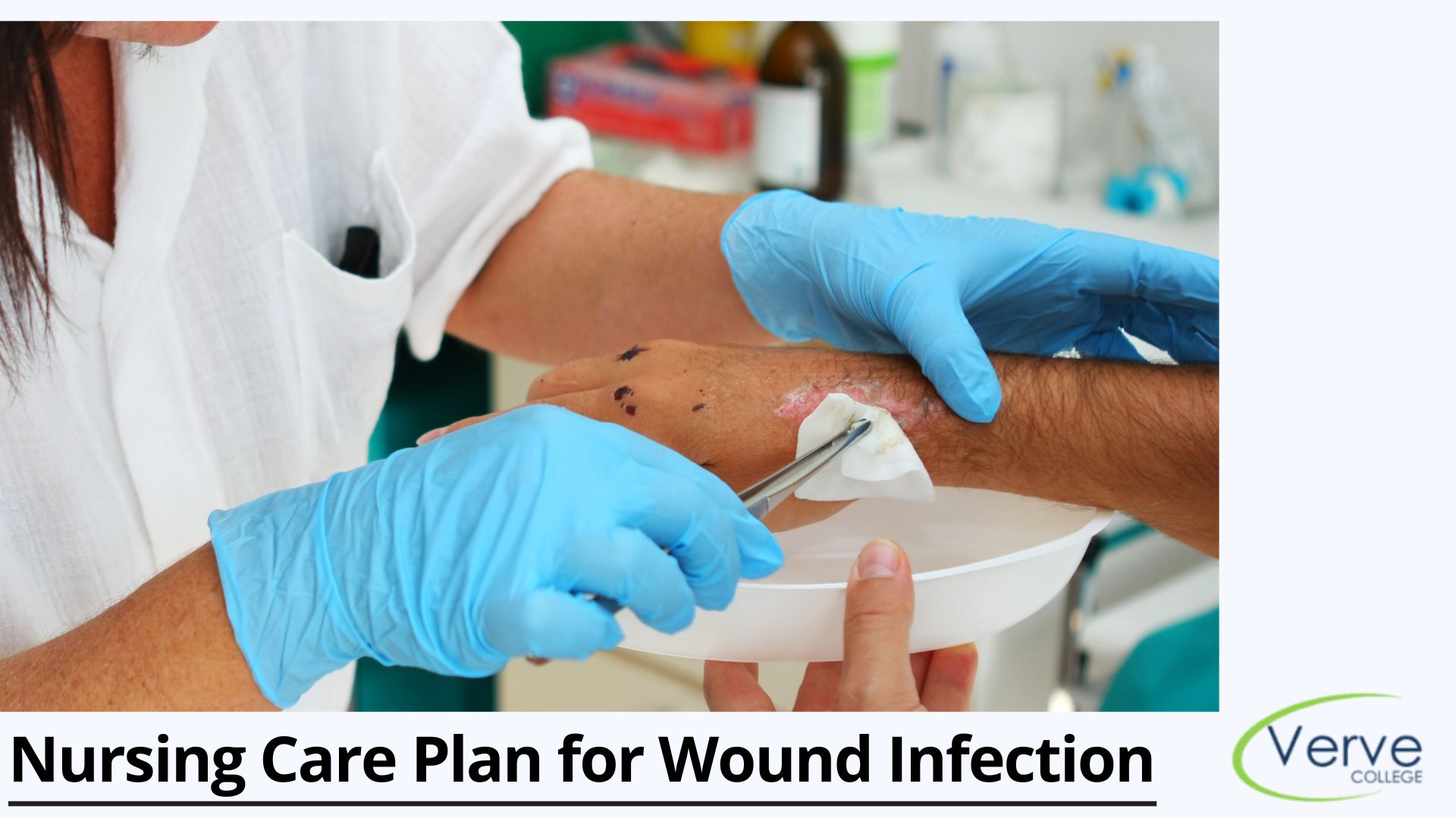 Step-by-Step Guide to a Nursing Care Plan for Wound Infection Treatment